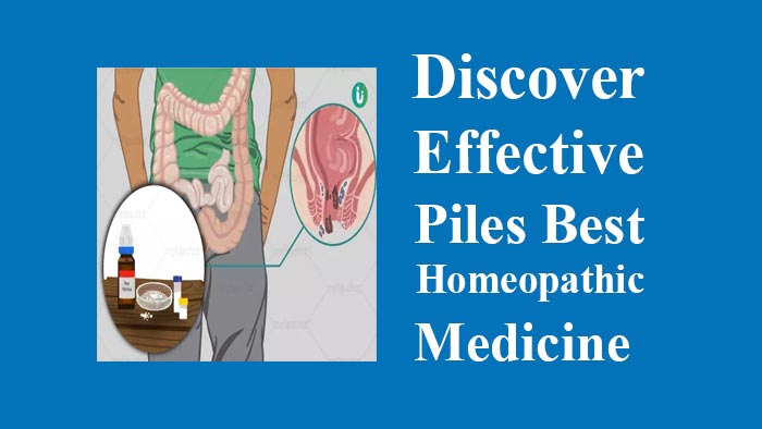 Piles Homeopathic Medicine in Bengali